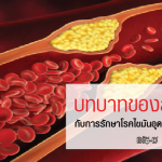 บทบาทของสมุนไพรกับการรักษาโรคไขมันในหลอดเลือดสูง,หลอดเลือดตีบ